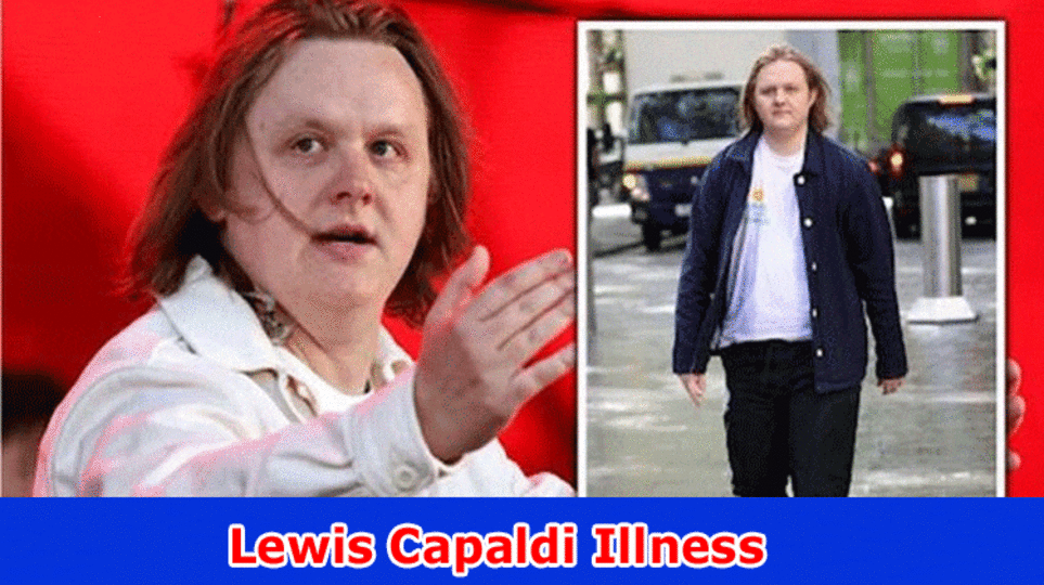 Lewis Capaldi Illness: Does Lewis Capaldi Have a Jerk?